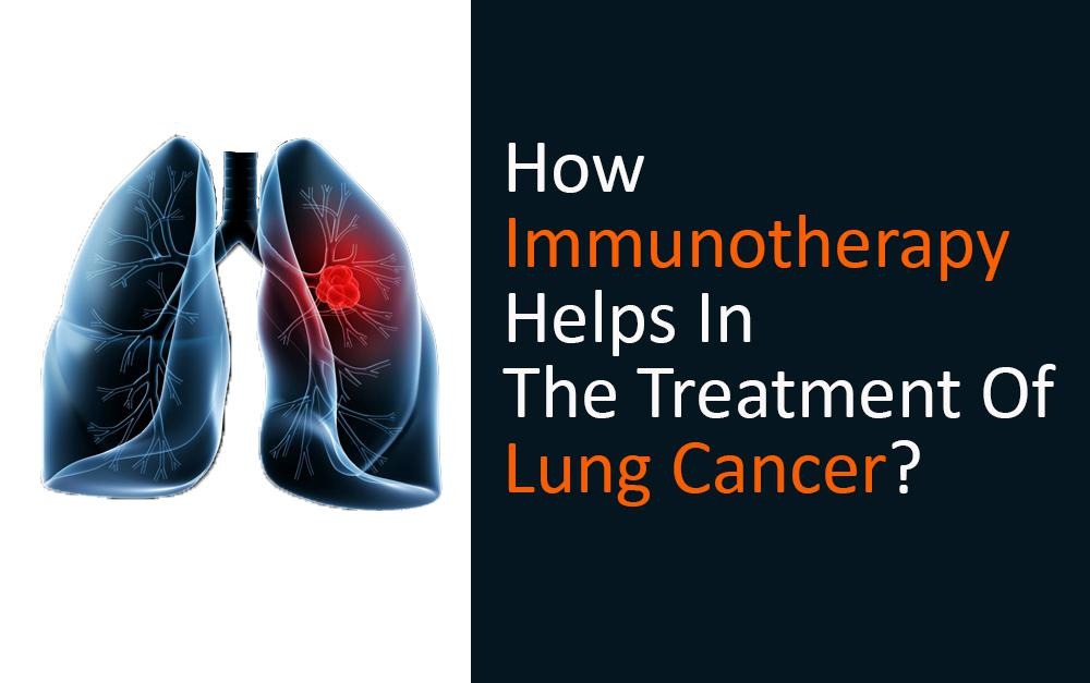 Immunotherapy treatment for lung cancer in India - Best hospitals