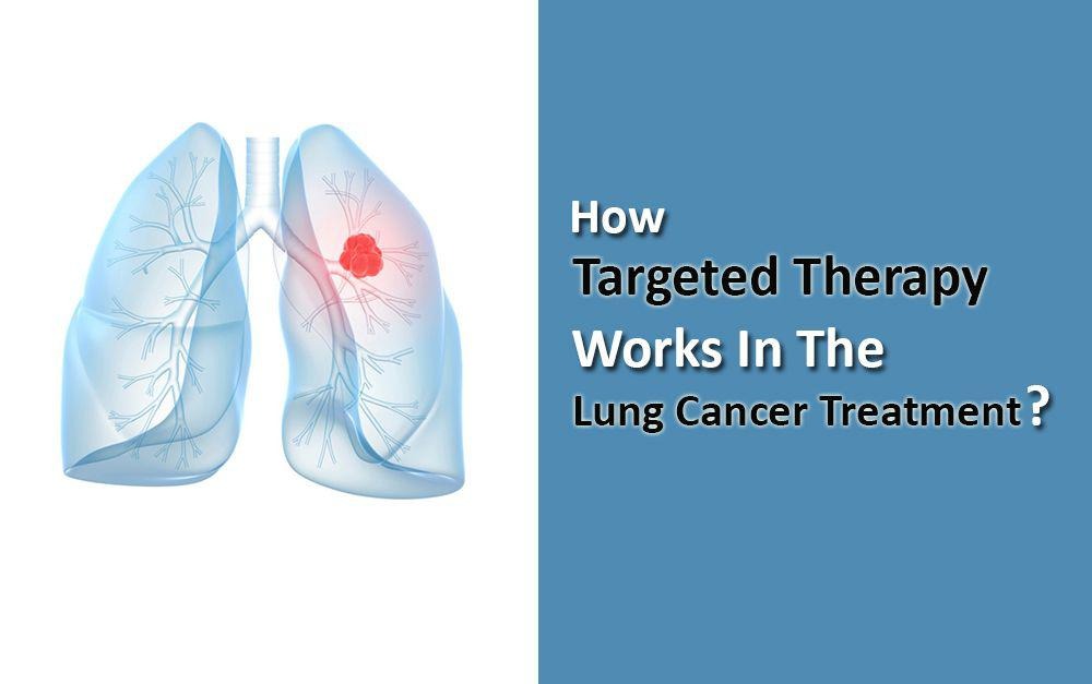 Target Therapy In India For Lung Cancer Chemotherapy Hbg