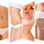 Liposuction (Body Fat Removal)_11zon