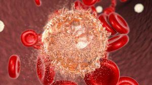 Stem Cell Transplantation for treatment of Eosinophilic leukemia