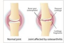Normal Joint Functioning