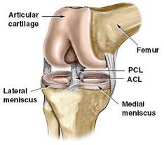 ACL reconstruction 2