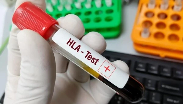 HLA Typing Test Cost in India